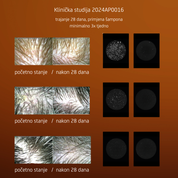 Anti-Dandruff Šampon